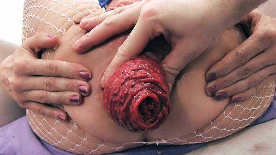 Натали черри анал пролапс