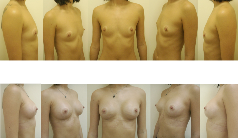 Голые сиськи разного размера