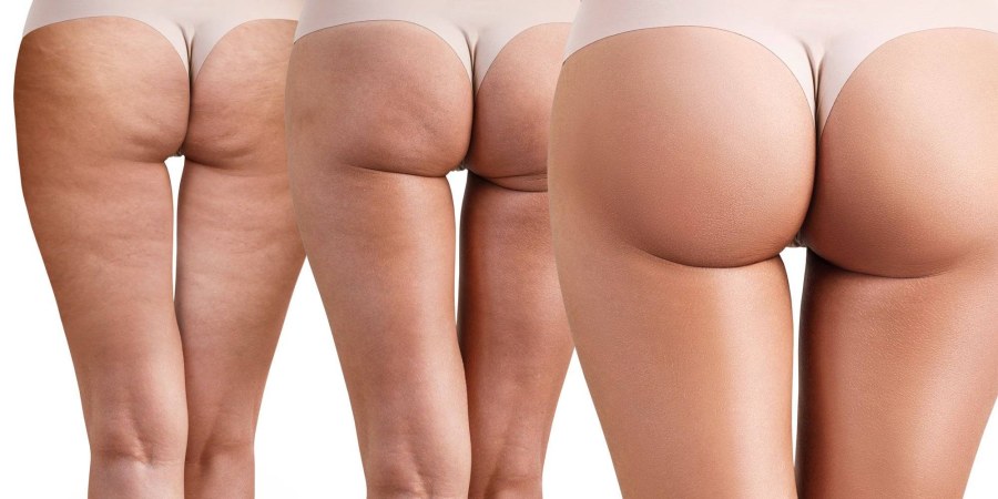 Попы без целлюлита