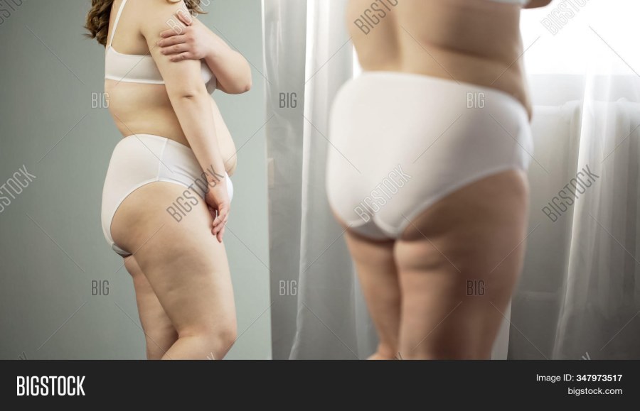 Фигура с целлюлитом у зеркала