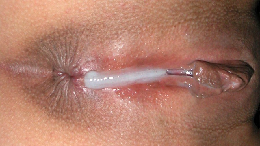 Мастурбация женской уретры