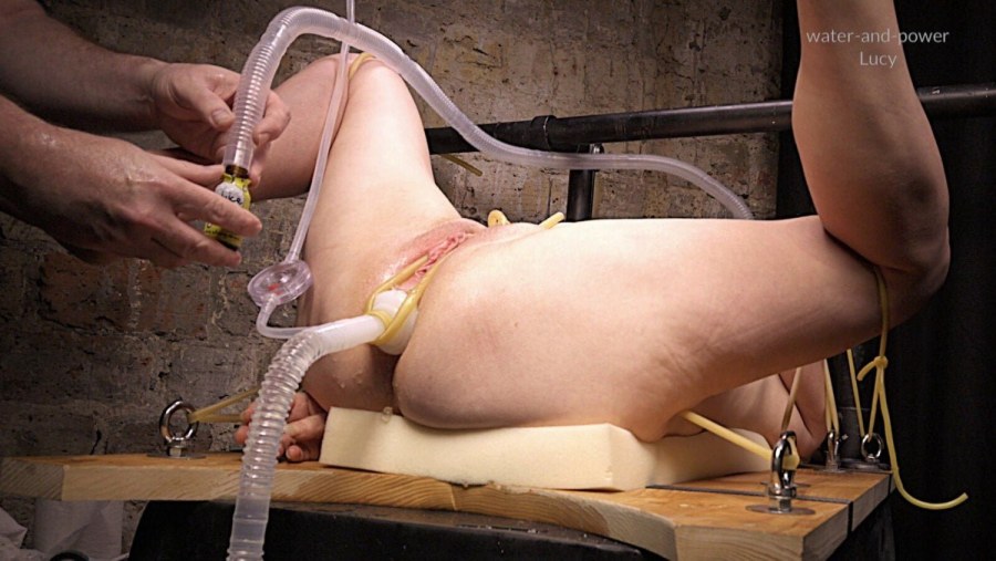 Вывернутые стенки влагалища