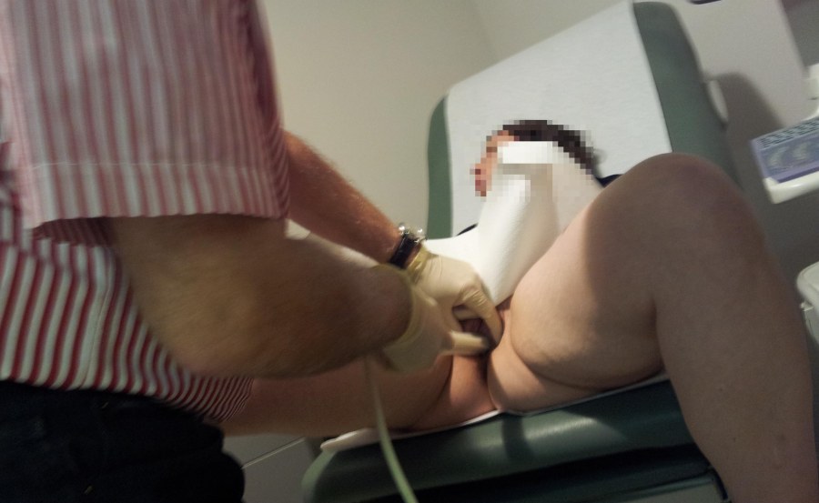 Голые бабы в гинекологическом кресле