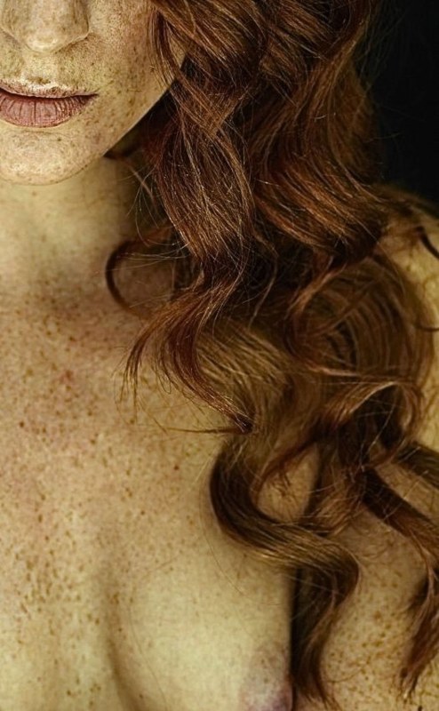 Девушка вся в веснушках